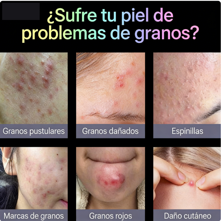 AliExpress In-Stock Cartoon Pimple Patches Cute Cat Paw Ice Cream pe Acne Covering Patch Portable Shaped Acne Clearing Patch Wholesale