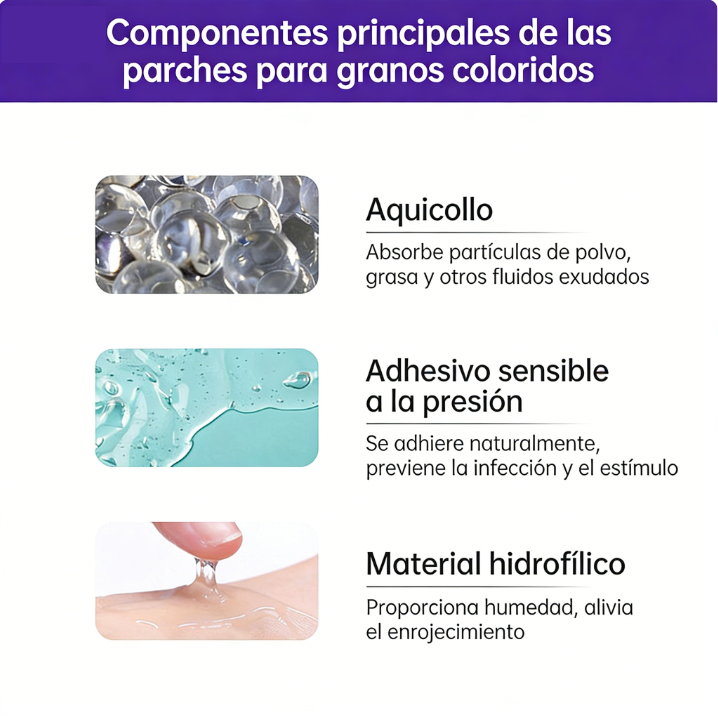 AliExpress In-Stock Cartoon Pimple Patches Cute Cat Paw Ice Cream pe Acne Covering Patch Portable Shaped Acne Clearing Patch Wholesale