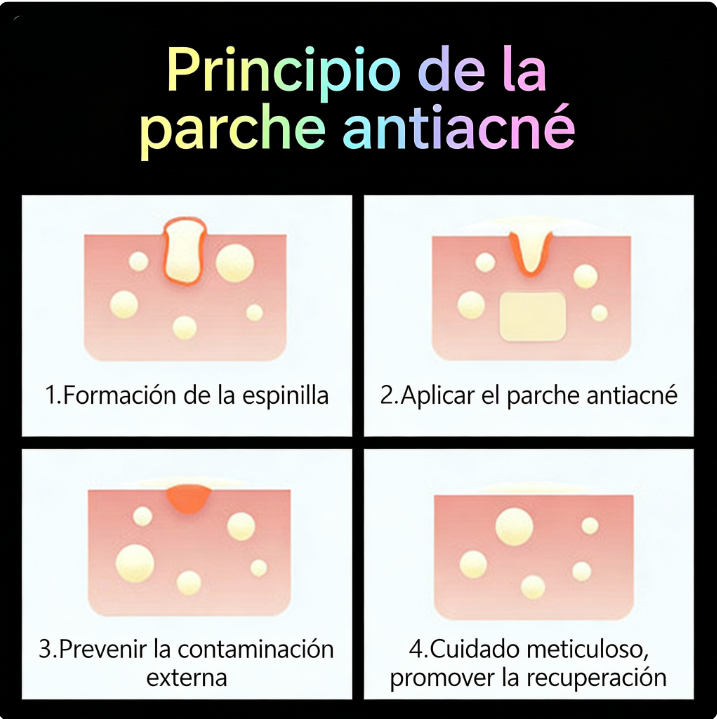 AliExpress In-Stock Cartoon Pimple Patches Cute Cat Paw Ice Cream pe Acne Covering Patch Portable Shaped Acne Clearing Patch Wholesale